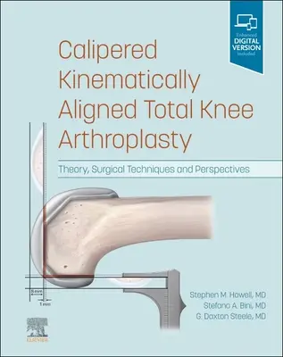 Kalibrierte kinematisch ausgerichtete Knie-Totalendoprothese: Theorie, chirurgische Techniken und Perspektiven - Calipered Kinematically Aligned Total Knee Arthroplasty: Theory, Surgical Techniques and Perspectives