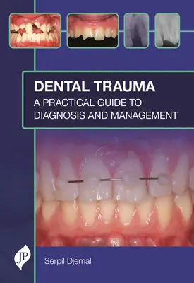 Zahnärztliches Trauma: Ein praktischer Leitfaden für Diagnose und Management - Dental Trauma: A Practical Guide to Diagnosis and Management