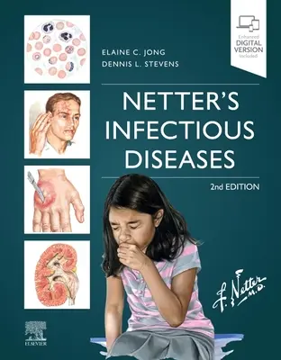 Netter's Infektionskrankheiten - Netter's Infectious Diseases