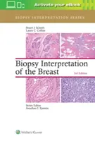 Interpretation der Biopsie der Brust - Biopsy Interpretation of the Breast