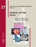 Tumore in der Leber - Tumors of the Liver