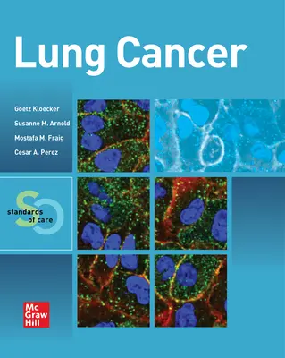 Lungenkrebs: Standards der Behandlung - Lung Cancer: Standards of Care