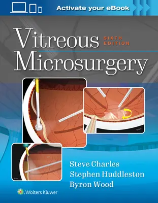 Mikrochirurgie des Glaskörpers - Vitreous Microsurgery