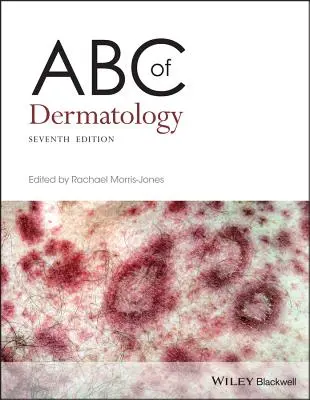 ABC der Dermatologie - ABC of Dermatology