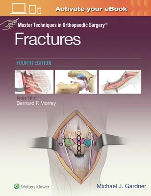 Meistertechniken in der orthopädischen Chirurgie: Frakturen - Master Techniques in Orthopaedic Surgery: Fractures