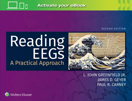 EEGs lesen: Eine praktische Herangehensweise - Reading Eegs: A Practical Approach