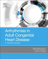 Arrhythmien bei angeborenen Herzfehlern bei Erwachsenen: Ein fallbasierter Ansatz - Arrhythmias in Adult Congenital Heart Disease: A Case-Based Approach