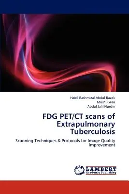 FDG-PET/CT-Scans der extrapulmonalen Tuberkulose - FDG PET/CT scans of Extrapulmonary Tuberculosis