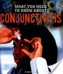 Was Sie über Bindehautentzündung (Conjunctivitis) wissen müssen - What You Need to Know about Conjunctivitis