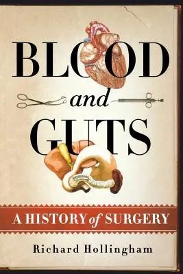 Blut und Gedärme: Eine Geschichte der Chirurgie - Blood and Guts: A History of Surgery
