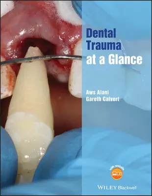 Zahntrauma auf einen Blick - Dental Trauma at a Glance