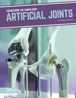 Künstliche Gelenke - Artificial Joints