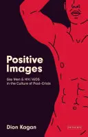 Positive Bilder: Schwule Männer und Hiv/AIDS in der Kultur der „Nach-Krise - Positive Images: Gay Men and Hiv/AIDS in the Culture of 'Post Crisis'