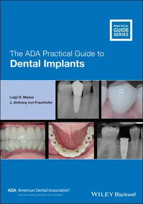 Der ADA-Leitfaden für Zahnimplantate - The ADA Practical Guide to Dental Implants