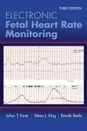 Elektronische Überwachung der fötalen Herzfrequenz: Das 5-stufige System: Das 5-stufige System - Electronic Fetal Heart Rate Monitoring: The 5-Tier System: The 5-Tier System