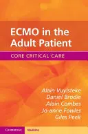 ECMO bei einem erwachsenen Patienten - ECMO in the Adult Patient