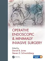 Operative endoskopische und minimalinvasive Chirurgie - Operative Endoscopic and Minimally Invasive Surgery