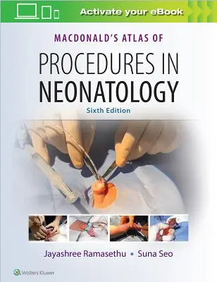 Macdonalds Atlas der Verfahren in der Neonatologie - Macdonald's Atlas of Procedures in Neonatology