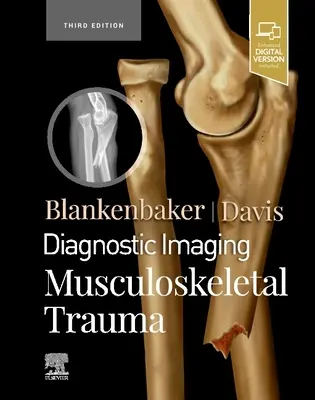Diagnostische Bildgebung: Muskuloskelettale Traumata - Diagnostic Imaging: Musculoskeletal Trauma