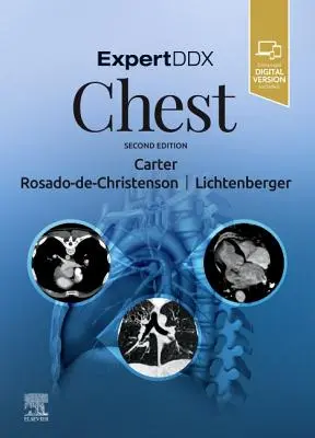 ExpertDDx: Brustkorb - ExpertDDx: Chest