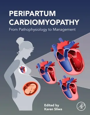Peripartale Kardiomyopathie: Von der Pathophysiologie zum Management - Peripartum Cardiomyopathy: From Pathophysiology to Management