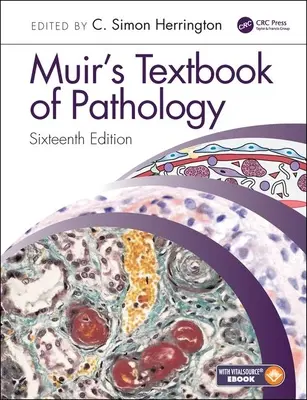 Muir's Lehrbuch der Pathologie - Muir's Textbook of Pathology