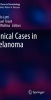 Klinische Fälle von Melanomen - Clinical Cases in Melanoma