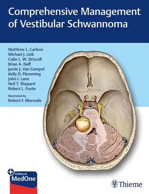 Umfassendes Management des vestibulären Schwannoms - Comprehensive Management of Vestibular Schwannoma