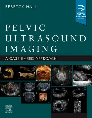 Becken-Ultraschall-Bildgebung: Ein fallbasierter Ansatz - Pelvic Ultrasound Imaging: A Cased-Based Approach