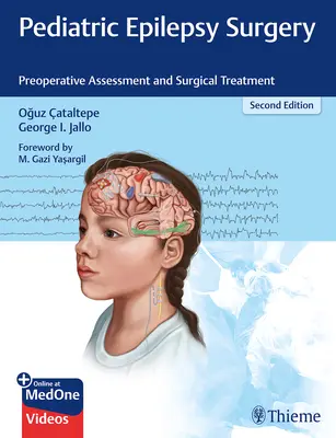 Pädiatrische Epilepsiechirurgie: Präoperative Beurteilung und chirurgische Behandlung - Pediatric Epilepsy Surgery: Preoperative Assessment and Surgical Treatment