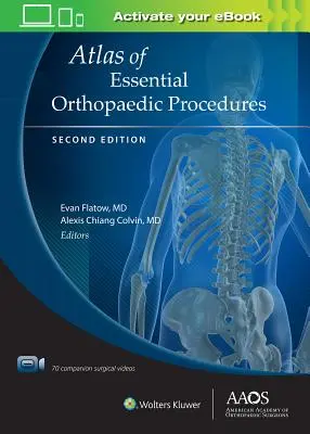 Atlas der wesentlichen orthopädischen Verfahren, zweite Auflage: Print + eBook mit Multimedia - Atlas of Essential Orthopaedic Procedures, Second Edition: Print + eBook with Multimedia