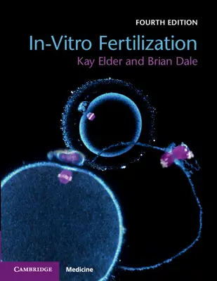In-vitro-Fertilisation - In-Vitro Fertilization