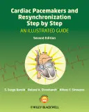 Herzschrittmacher und Resynchronisation Schritt für Schritt: Ein illustrierter Leitfaden - Cardiac Pacemakers and Resynchronization Step by Step: An Illustrated Guide