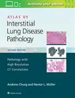 Atlas der Pathologie der interstitiellen Lungenerkrankung - Atlas of Interstitial Lung Disease Pathology