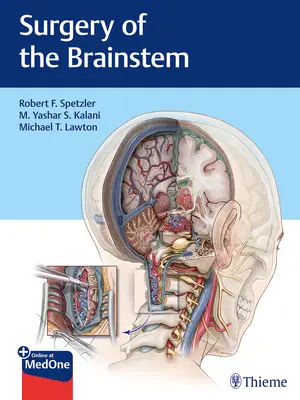 Chirurgie des Hirnstamms - Surgery of the Brainstem