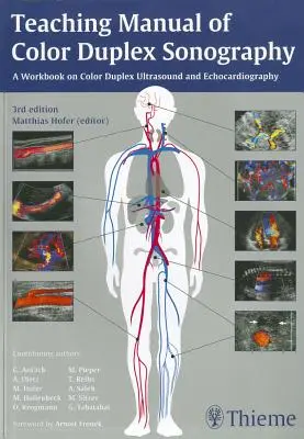 Lehrhandbuch der Farbduplexsonographie - Teaching Manual of Color Duplex Sonography