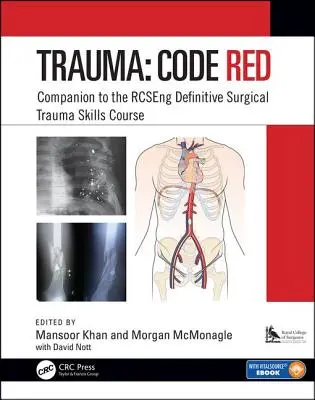 Trauma: Code Red: Begleitbuch zum Rcseng-Kurs für chirurgische Trauma-Fertigkeiten - Trauma: Code Red: Companion to the Rcseng Definitive Surgical Trauma Skills Course