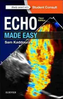 Echo leicht gemacht - Echo Made Easy