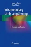 Intramedulläre Gliedmaßen-Verlängerung: Prinzipien und Praxis - Intramedullary Limb Lengthening: Principles and Practice