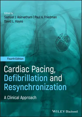 Herzschrittmacher, Defibrillation und Resynchronisation: Eine klinische Herangehensweise - Cardiac Pacing, Defibrillation and Resynchronization: A Clinical Approach