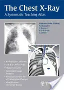 Die Röntgenaufnahme der Brust: Ein systematischer Lehratlas - The Chest X-Ray: A Systematic Teaching Atlas