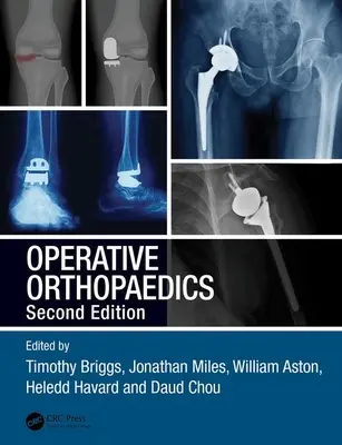 Operative Orthopädie - Operative Orthopaedics