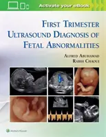 Ersttrimester-Ultraschalldiagnose fötaler Anomalien - First Trimester Ultrasound Diagnosis of Fetal Abnormalities