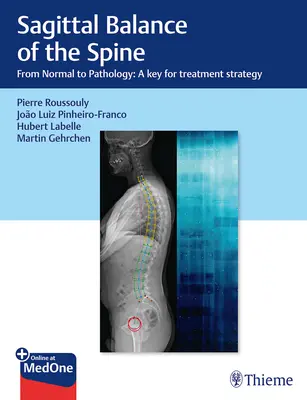 Sagittales Gleichgewicht der Wirbelsäule: Vom Normalzustand zur Pathologie: Ein Schlüssel zur Behandlungsstrategie - Sagittal Balance of the Spine: From Normal to Pathology: A Key for Treatment Strategy