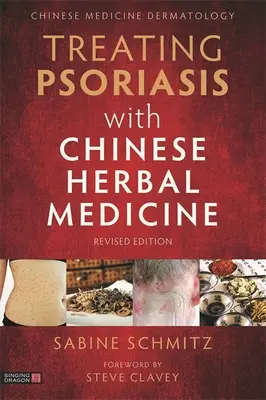 Behandlung der Schuppenflechte mit chinesischer Kräutermedizin (überarbeitete Ausgabe): Ein praktisches Handbuch - Treating Psoriasis with Chinese Herbal Medicine (Revised Edition): A Practical Handbook