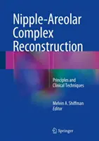 Rekonstruktion des Brustwarzen-Areolarkomplexes: Prinzipien und klinische Techniken - Nipple-Areolar Complex Reconstruction: Principles and Clinical Techniques