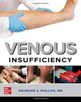 Venöse Unzulänglichkeit - Venous Insufficiency