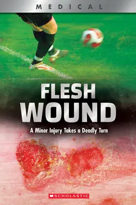 Fleischwunde (Xbooks): Eine kleine Verletzung nimmt eine tödliche Wendung - Flesh Wound (Xbooks): A Minor Injury Takes a Deadly Turn