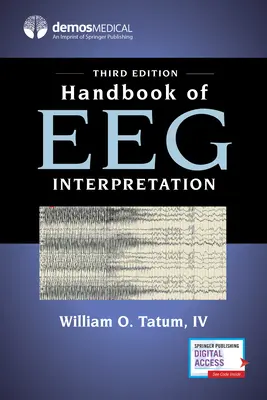 Handbuch der EEG-Interpretation - Handbook of Eeg Interpretation