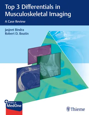 Die 3 wichtigsten Differentialdiagnosen in der muskuloskelettalen Bildgebung: Eine Fallbesprechung - Top 3 Differentials in Musculoskeletal Imaging: A Case Review
